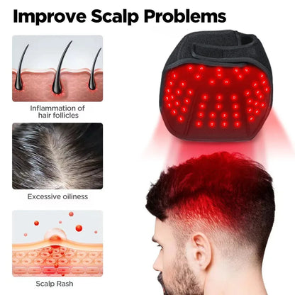 660nm 850nm Red & Infrared Light Hair Growth Cap, USB Charging Red Light Therapy Device Hair Loss Treatment Hair Regrowth Helmet